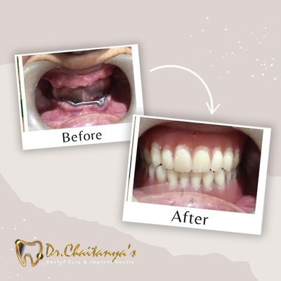 Dental Clinic in Jeevan Bima Nagar