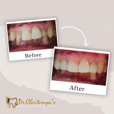 Dental Clinic in Jeevan Bima Nagar