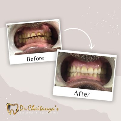 Dental Clinic in Jeevan Bima Nagar