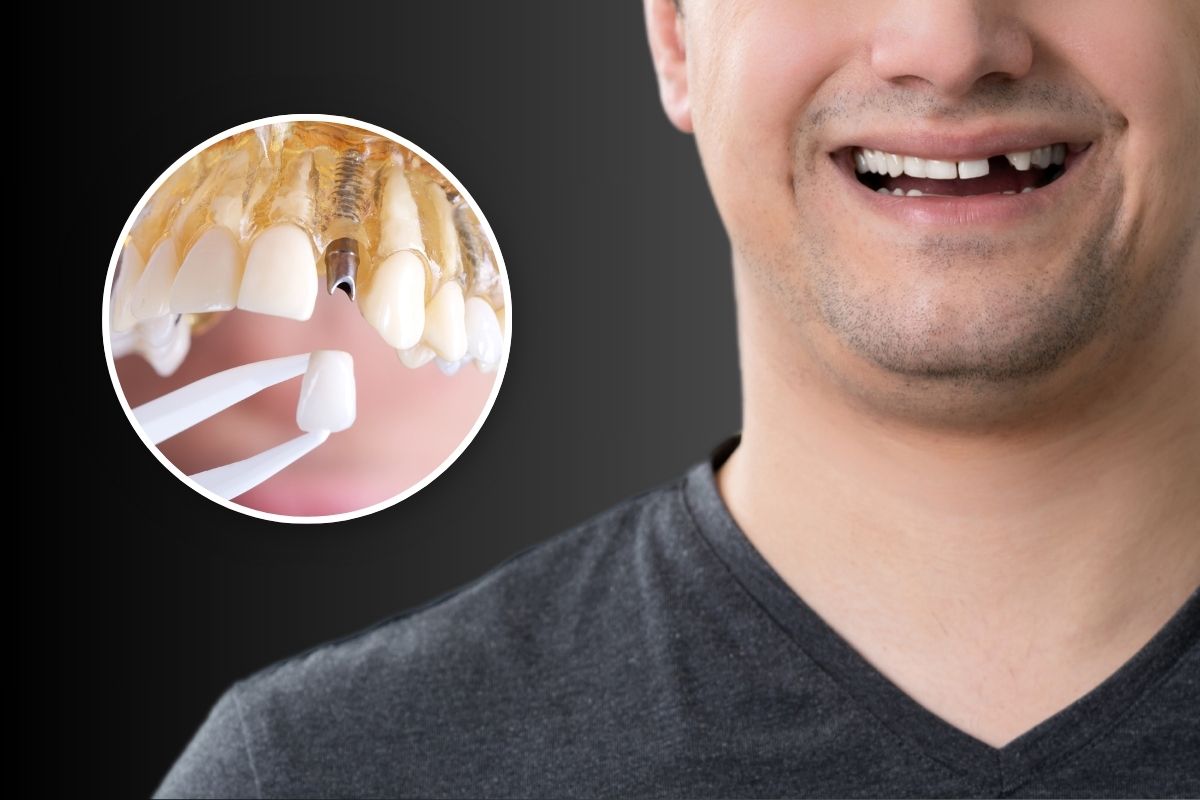 Dentist in Jeevan Bima Nagar